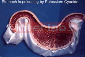 Stomach in poisoning by potassium cyanide